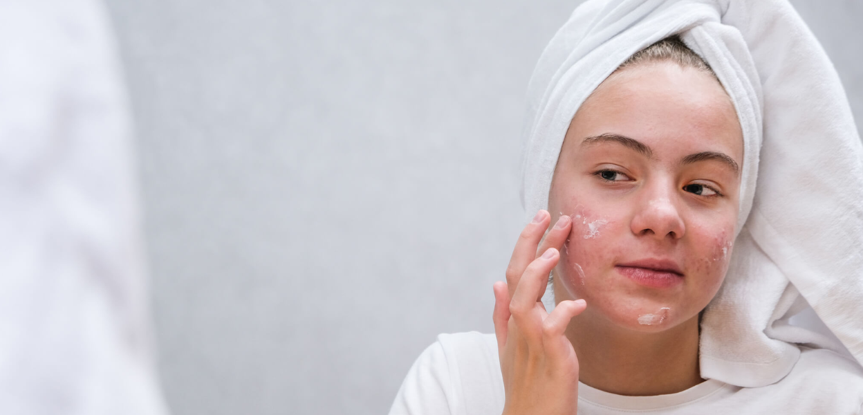 glow-boosting-tropeaka-picks